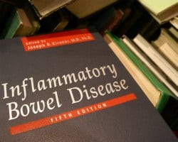 Treating Inflammatory Bowel Disease (IBD) 